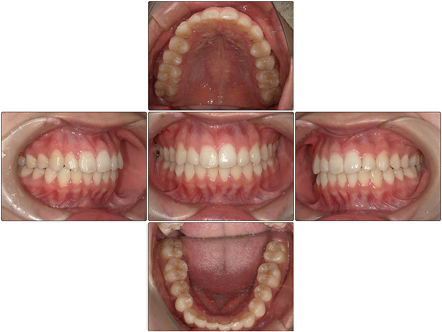 お口の中全体の写真After