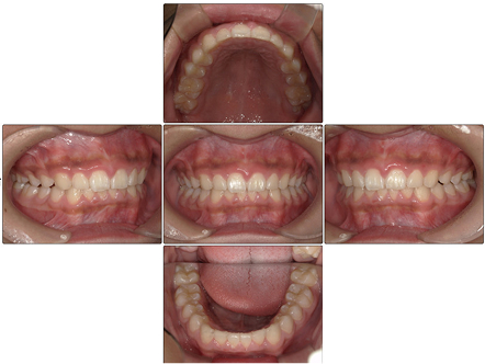 お口の中全体の写真After