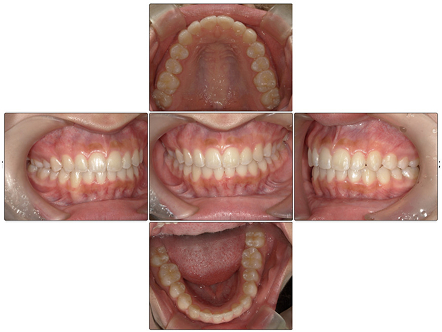 お口の中全体の写真After